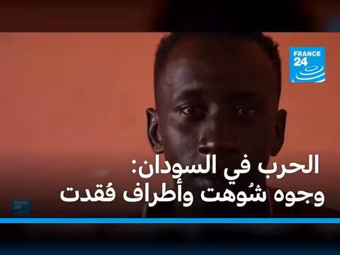 الحرب في السودان: وجوه شوهت وأطراف فُقدت