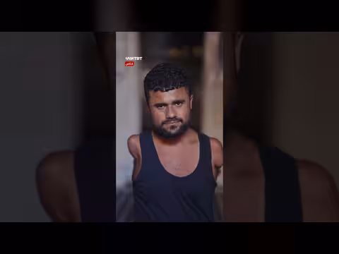 مصاب من غزة يروي قصة بتر أطرافه بعد حادث طائرة ورقية
