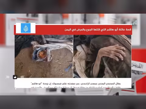 قصة عائلة يمنية تحت وطأة الجوع والمرض