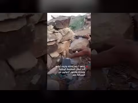 بطل من المقاومة الوطنية يواصل مقارعة الحوثيين رغم إصابته