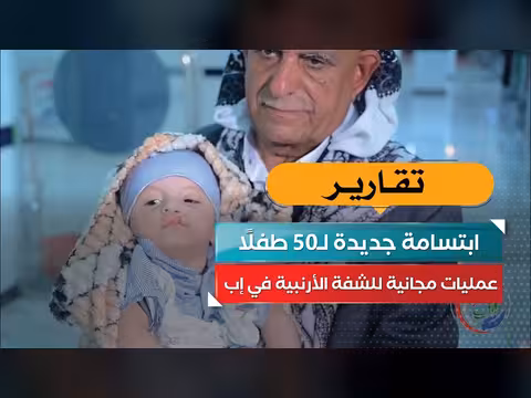 ابتسامة جديدة لخمسين طفلًا بعمليات مجانية في إب