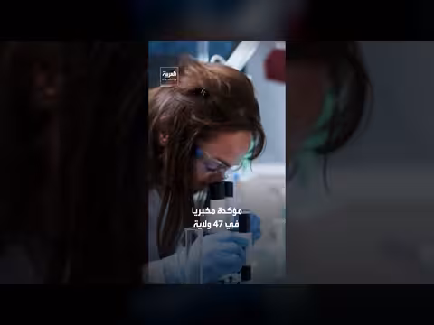 أميركا تسجل 10 آلاف إصابة بجرثومة السيكلوسبورا بسبب خس ملوث من المكسيك