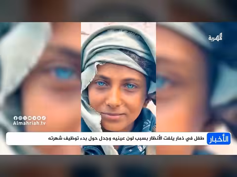 طفل في ذمار يلفت الأنظار بلون عينيه ويحقق ثلاثين مليون مشاهدة