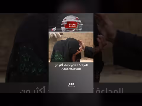 المجاعة تنهش أجساد أكثر من نصف سكان اليمن
