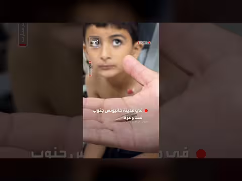 الجيش الإسرائيلي يطلق النار على ثلاثة أطفال في خانيونس جنوب غزة