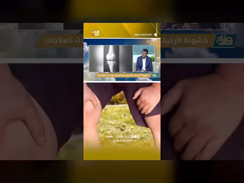 خشونة المفاصل: الأسباب والأعراض وأحدث طرق العلاج