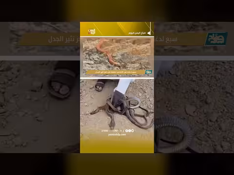 طفلة في تعز تتعرض لحالة نادرة بسبع لدغات ثعابين مختلفة