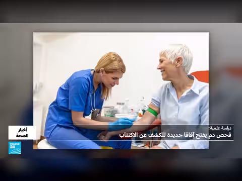 دراسة أمريكية تكشف عن إمكانية اكتشاف الاكتئاب عبر فحص الدم