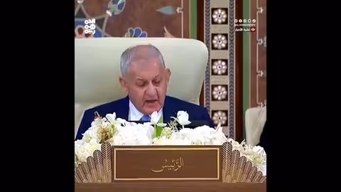 آثار مجاعة على جسدي طفلين فلسطينيين بسبب الحصار الإسرائيلي