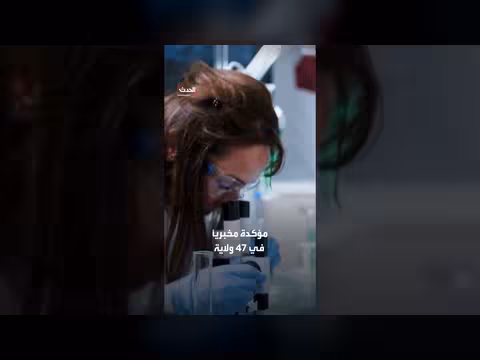 أميركا تسجل 10 آلاف إصابة بجرثومة السيكلوسبورا بسبب خس ملوث من المكسيك