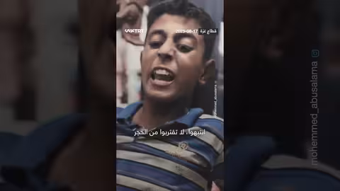 إصابة لم تمنعه من التمسك بزجاجة زيت