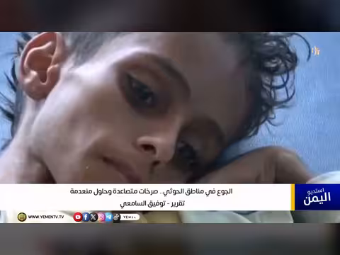 صراخ الجوع في مناطق الحوثي