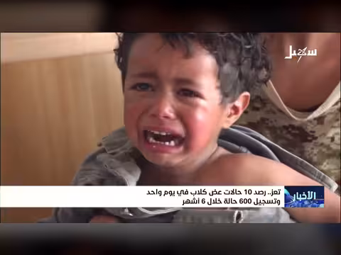رصد 10 حالات عض كلاب في يوم واحد ب تعز