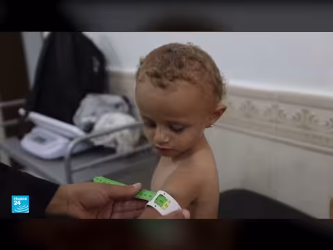 الوضع الإنساني في غزة كارثي وسط القصف وسوء التغذية