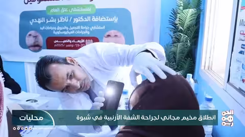 مخيم طبي مجاني لإصلاح الشفة الأرنبية ينطلق في شبوة