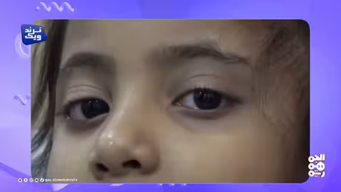 الطفلة رتيل.. حالة إنسانية يستجيب لها طارق صالح ترند ويك