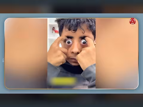شاهد مرونة جسدية مذهلة لطفل يمني في مقطع فيديو مثير