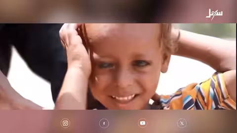 النزلة المعوية الشتوية: الأسباب، الأعراض، والوقاية