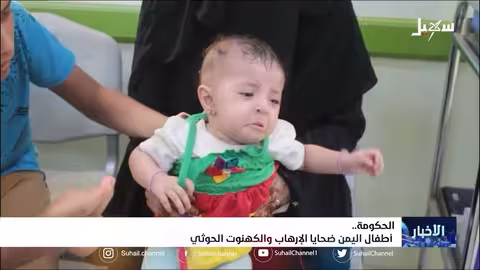 أطفال اليمن ضحايا الإرهاب والكهنوت الح.... وثي