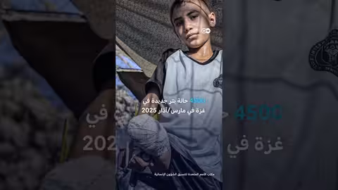 معاناة فنان يمني بعد إصابته وإعاقته