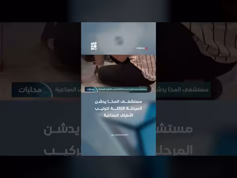 مستشفى المخا يدشن المرحلة الثالثة لتركيب الأطراف الصناعية