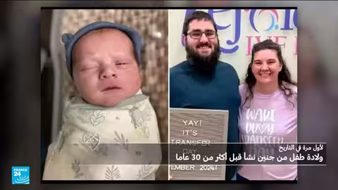 ولادة طفل من جنين مجمد لأكثر من 30 عاماً