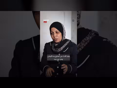 طفل يفقد بصره بسبب مخلفات الحرب ويحلم باستعادة نظره