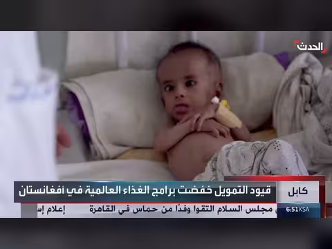 ملايين الأطفال والنساء في أفغانستان يواجهون سوء التغذية الحاد