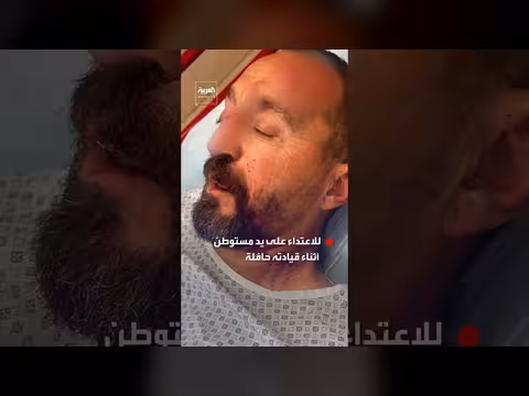 اعتداء مستوطن على سائق فلسطيني من جبل المكبر أثناء قيادة حافلة