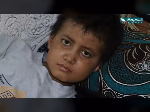 الطفل أسد يقاوم لوكيميا الدم