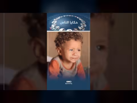مواطنون يأكلون أوراق الشجر وناشطون حوثيون يرددون أنا جاوع حكايا الناس