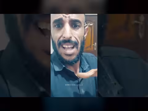 صرخة جوع تزعج الحوثيين