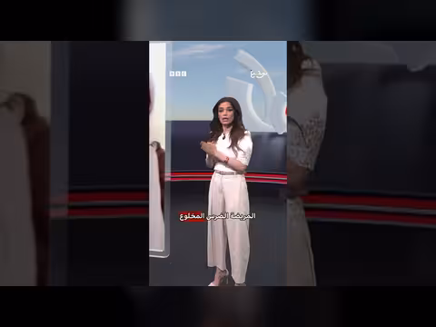 اعتداء على طبيبة أسنان مصرية بعد خلع ضرس