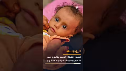 اليمن: تقزم الأطفال واختطاف الناشطين واختفاء طالب في باكستان