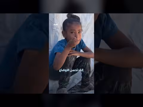 الجوع العالمي يتراجع للعام الثالث