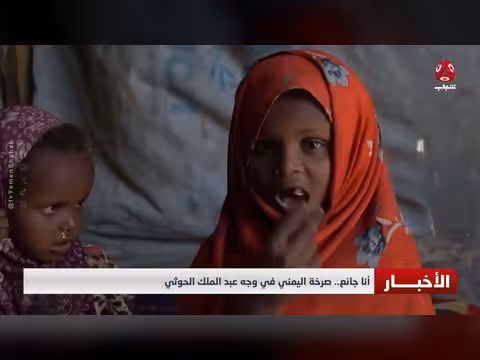 صرخة الجوع اليمني في وجه عبد الملك الحوثي