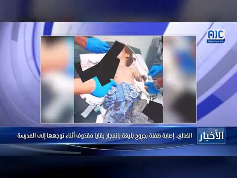 طفلة مصابة بجروح بليغة بانفجار بقايا مقذوف في الضالع