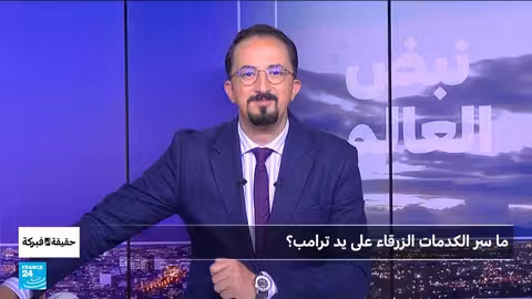 كدمات ترامب: بين الشائعات والتفسيرات الطبية