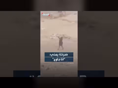 يمني من مناطق الحوثيين: عبد الملك الحوثي جوعنا