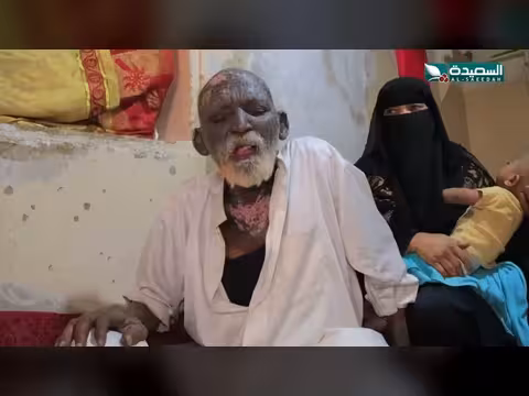 المسن حسن ينتظر يد العون بعد أن أنهكه المرض